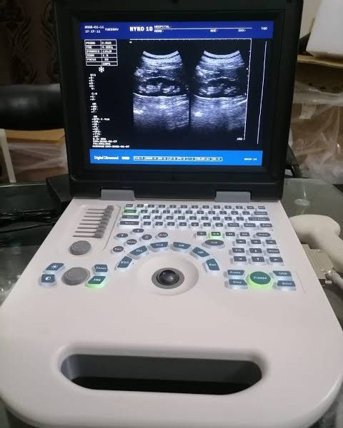 NYRO 10 Ultrasound Machine
