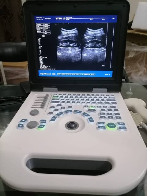 images (1) NYRO 10 Ultrasound Machine - Image 1